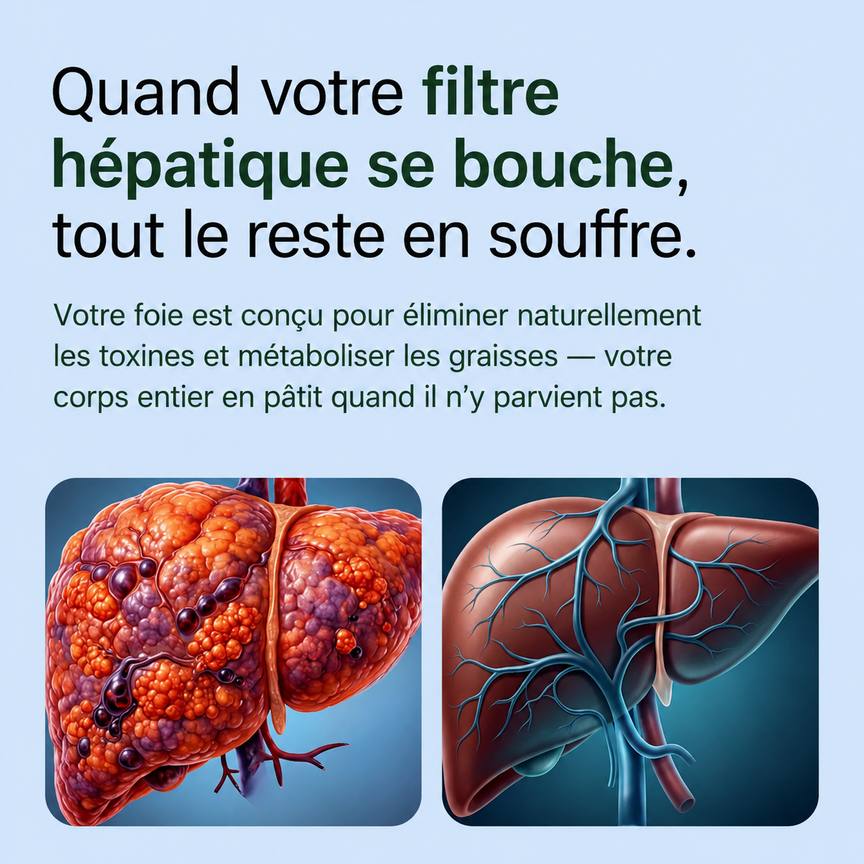 Purélia ™